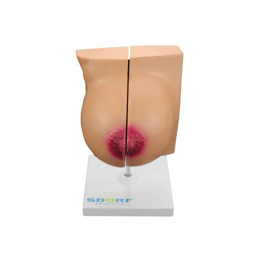 Glândula Mamária em Repouso Sdorf