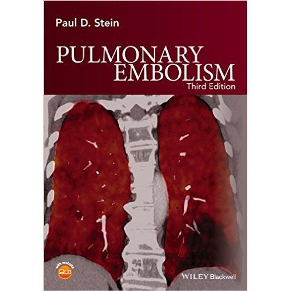 Pulmonary Embolism