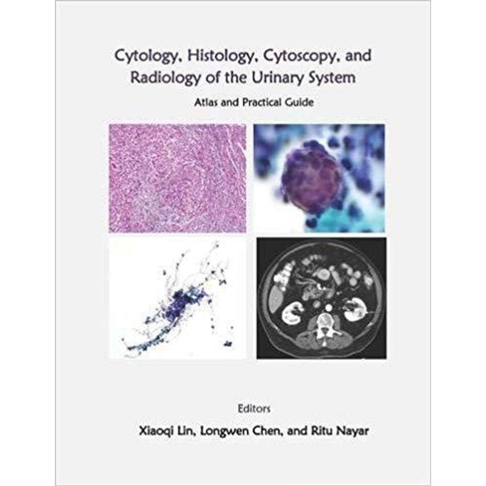 Urinary System: Cytology Histology Cystoscopy And Radiology