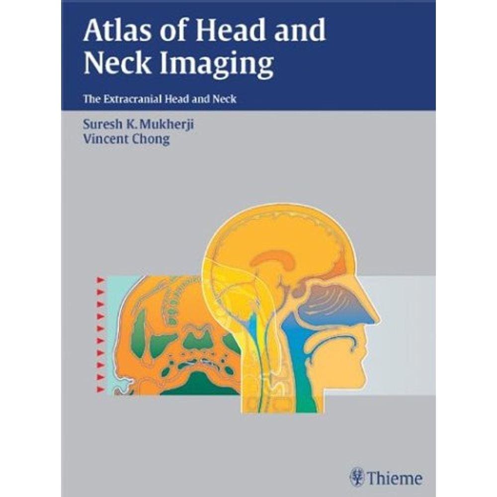 Atlas Of Head And Neck Imaging