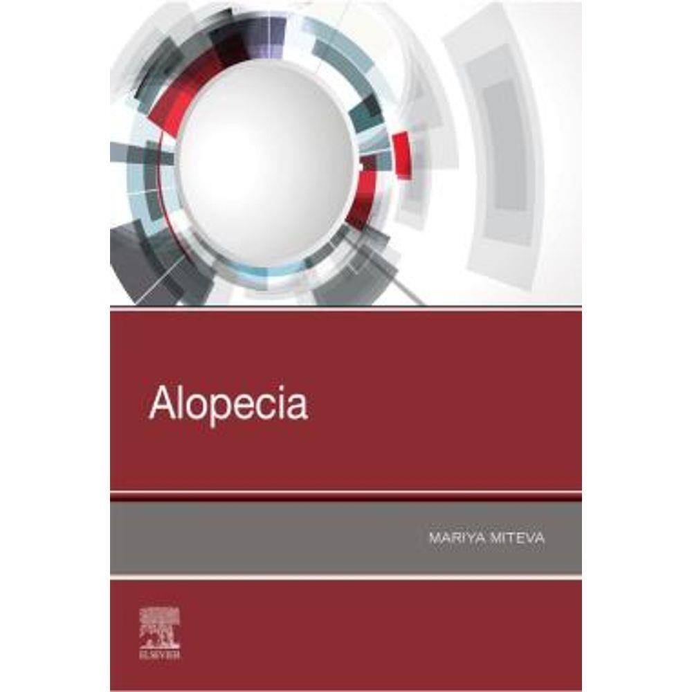 Alopecia