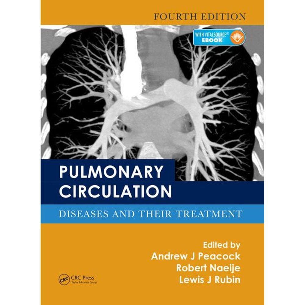 Pulmonary Circulation: Diseases And Their Treatment