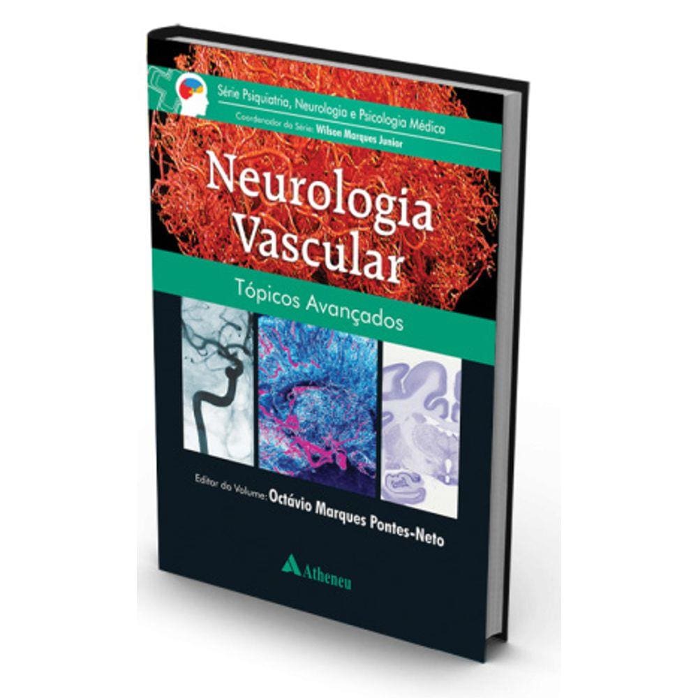 Neurologia Vascular-tópicos Avançados