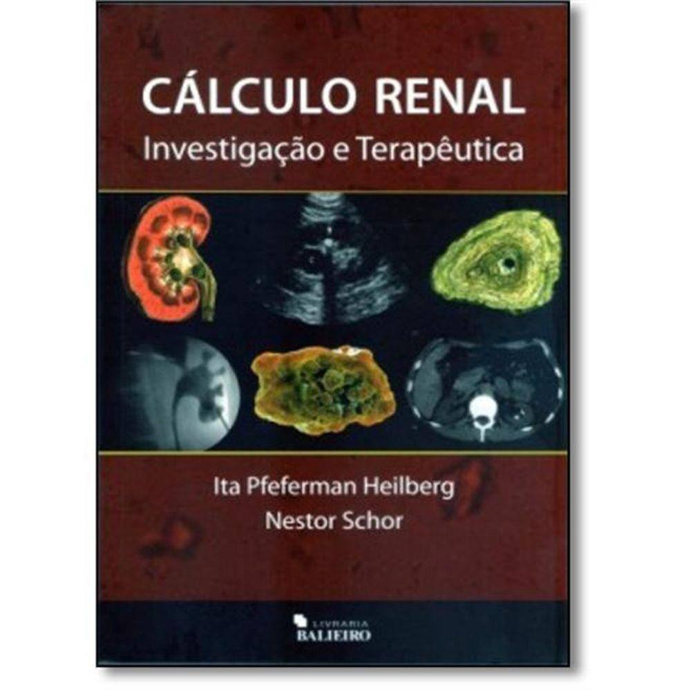 Cálculo Renal: Investigação E Terapêutica