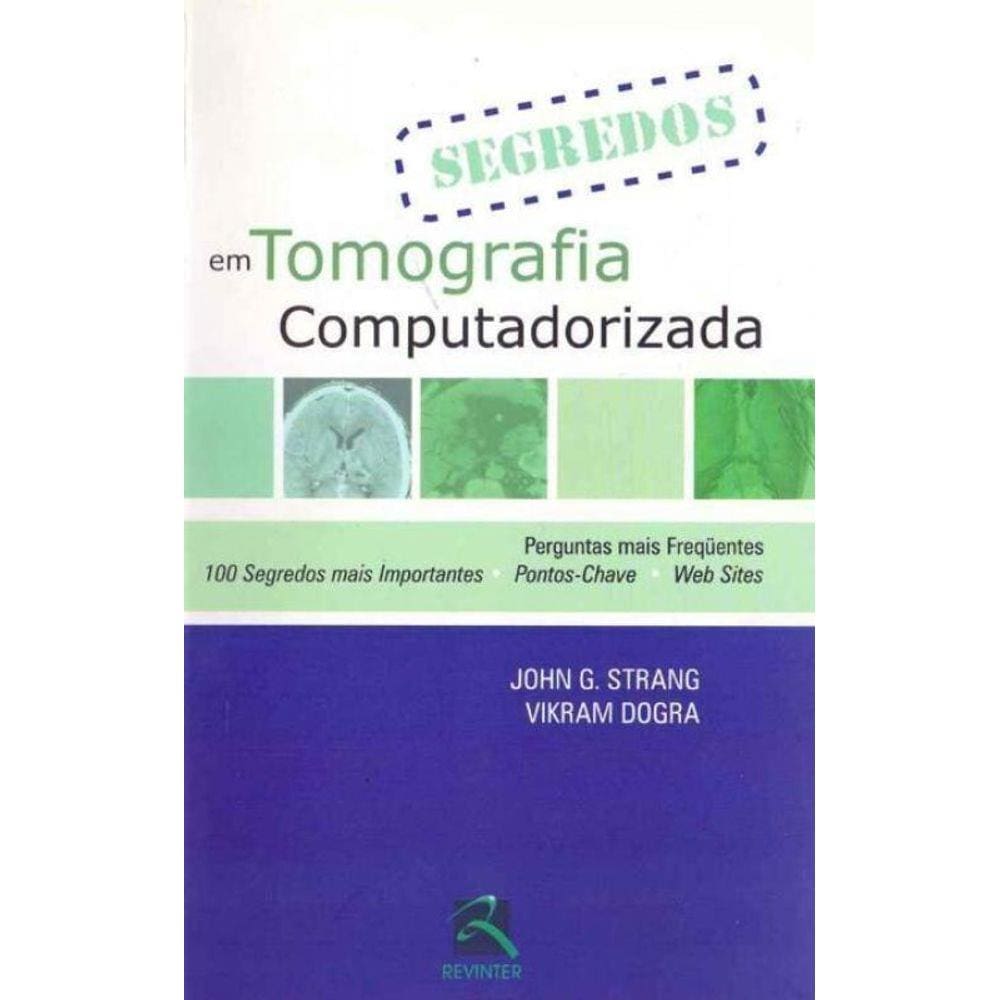 Segredos em Tomografia Compuitadorizada