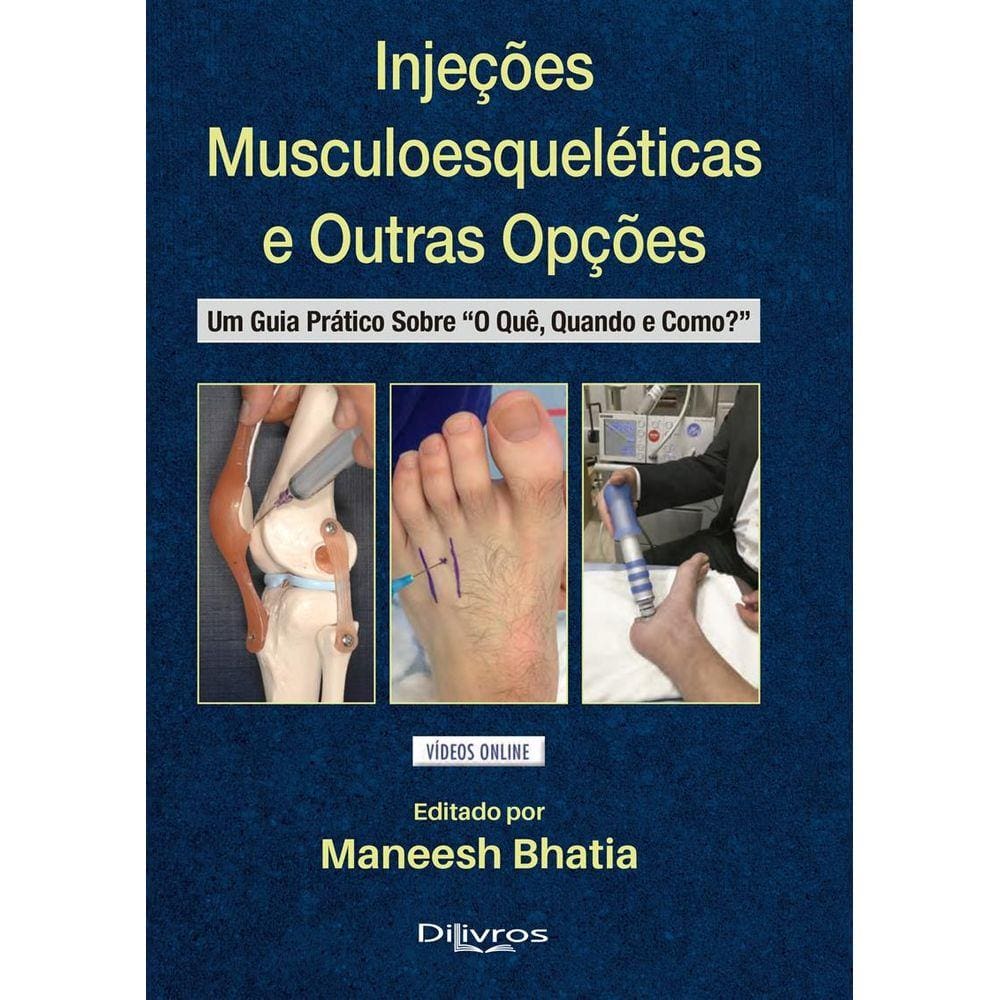 Injecoes Musculoesqueleticas E Outras Opcoes