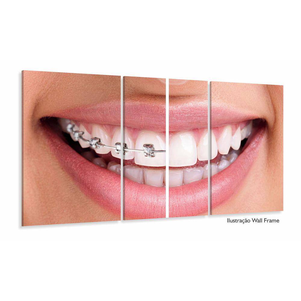 Quadro Decorativo Dentista Aparelho 63x130mt com 3 peças