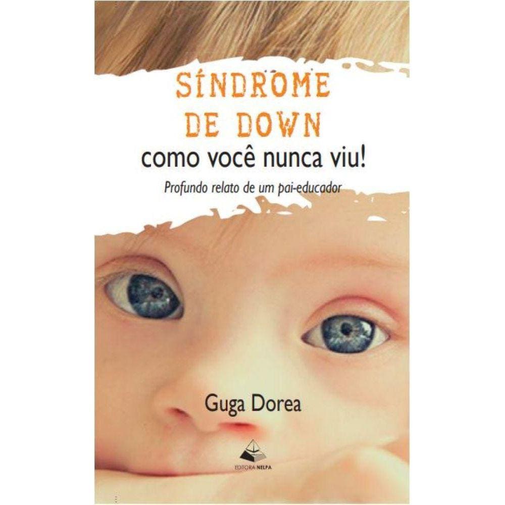 Síndrome de Down como você nunca viu