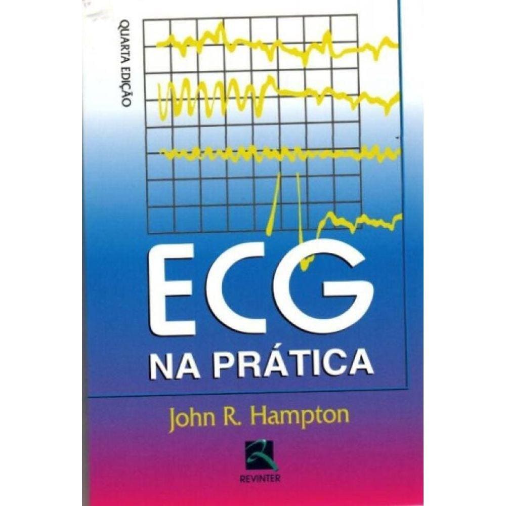 Ecg Na Prática