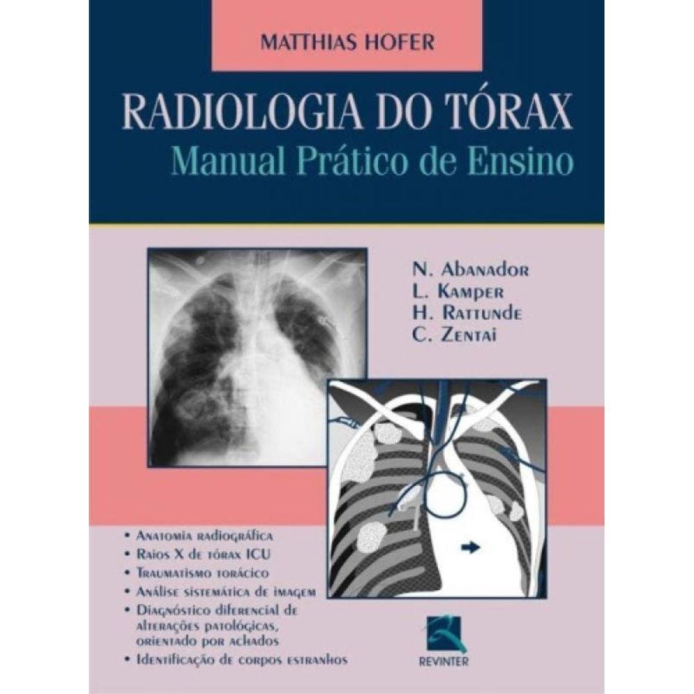Radiologia Do Tórax
