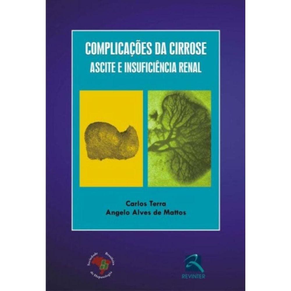 Complicações Da Cirrose