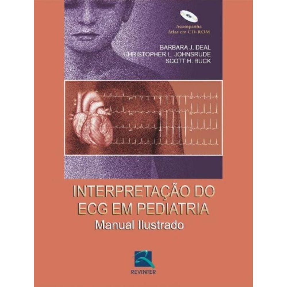 Interpretação Do Ecg Em Pediatria