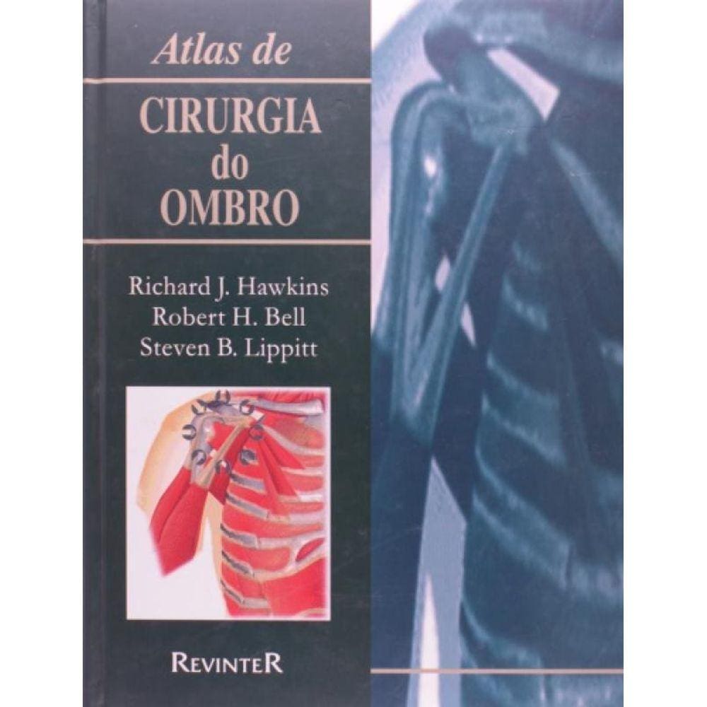 Atlas de Cirurgia do Ombro - 01Ed/99