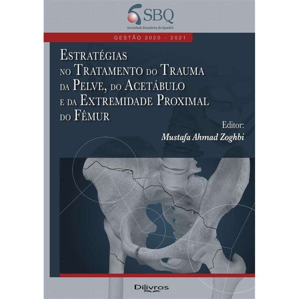 Estratégias no Tratamento do Trauma da Pelve, do Acetábulo e da Extremidade Proximal do Fêmur