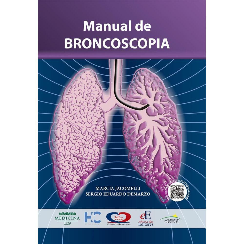 Manual De Broncoscopia