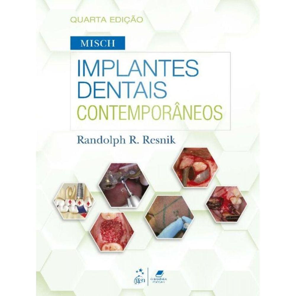 Misch - Implantes Dentais Contemporaneos - 04Ed/22