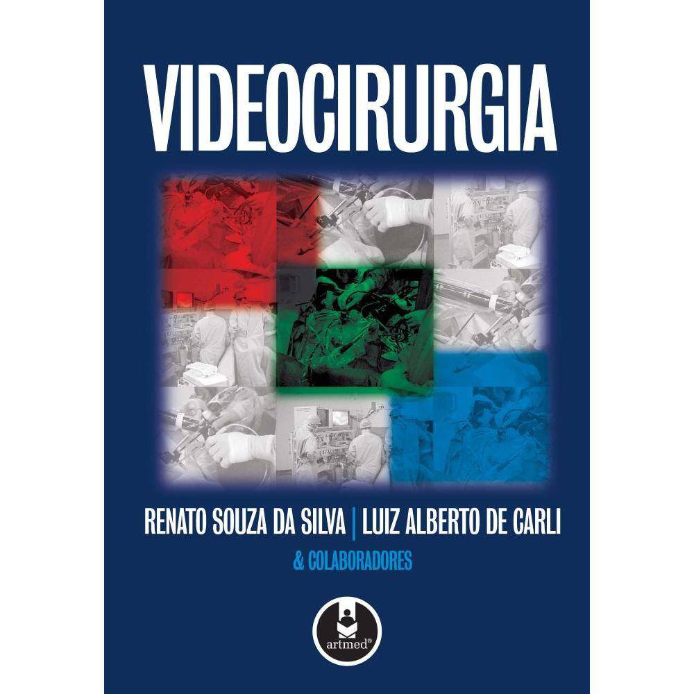 Videocirurgia
