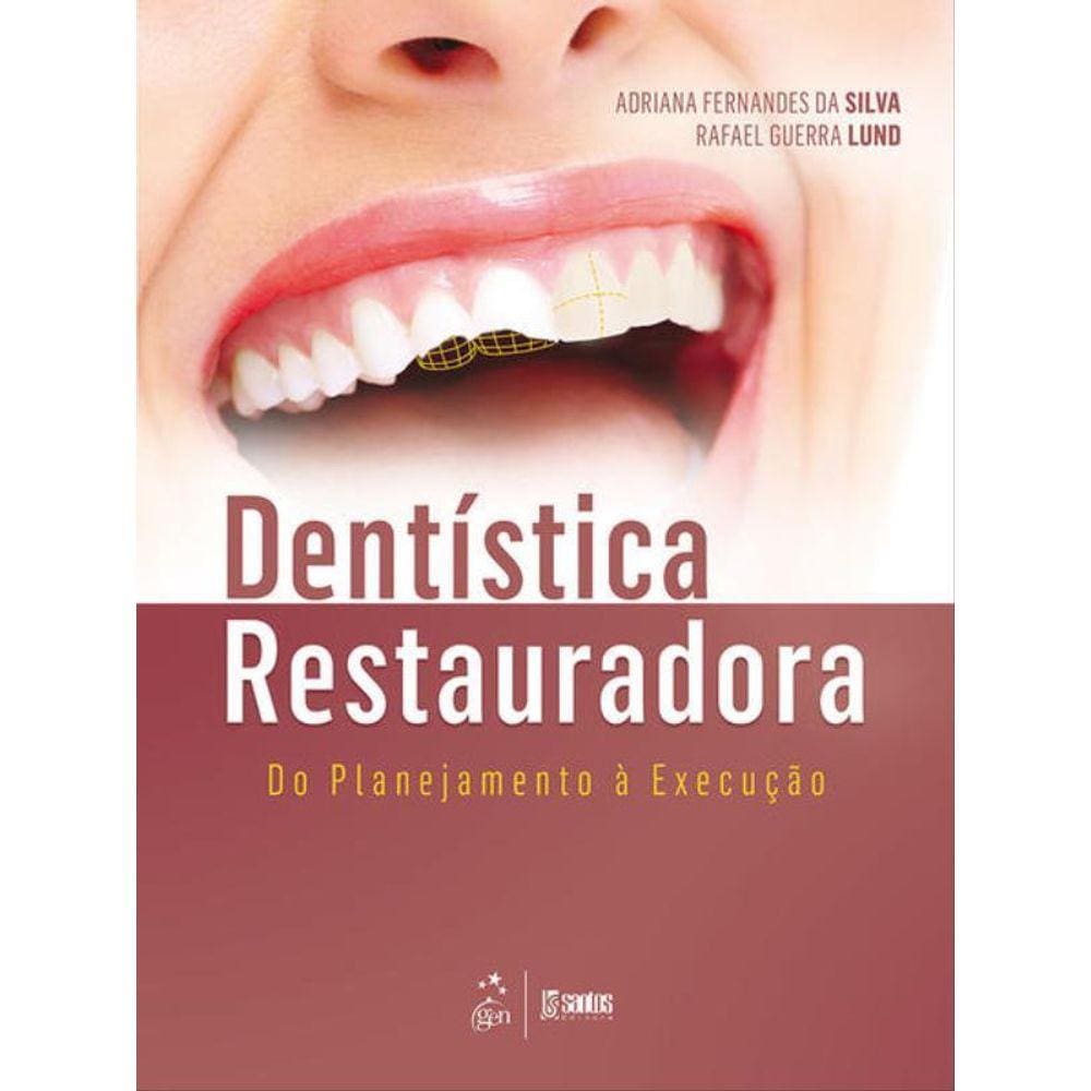 Dentística Restauradora - Do Planejamento À Execução