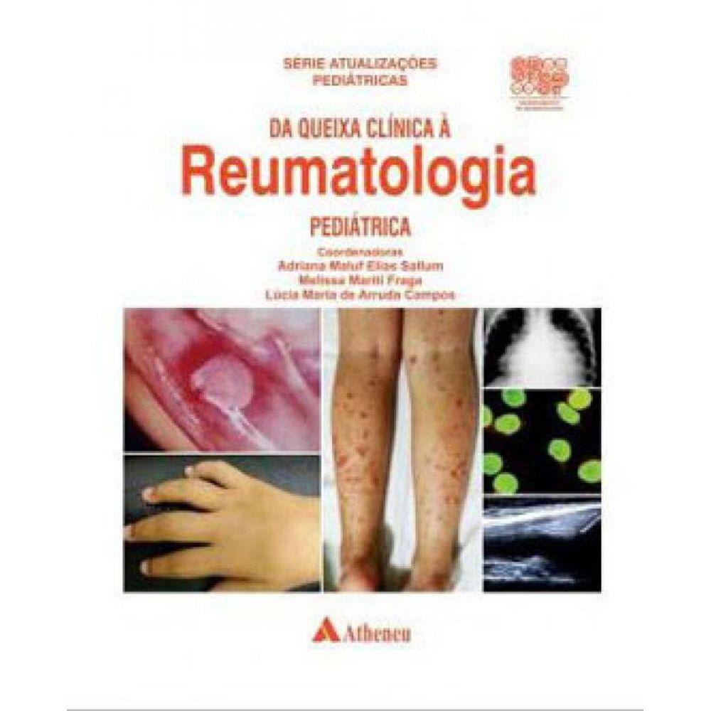 Da Queixa Clínica À Reumatologia Pediátrica