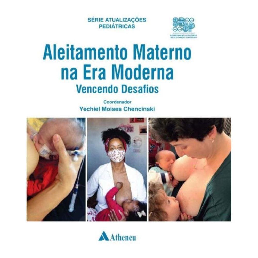 Aleitamento Materno Na Era Moderna - Vencendo Desafios - 01Ed/21