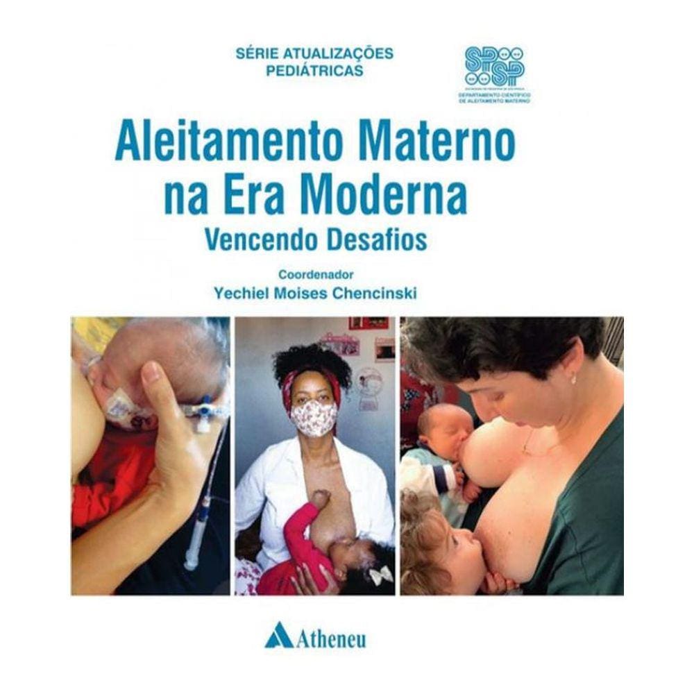 Aleitamento Materno Na Era Moderna - Vencendo Desafios