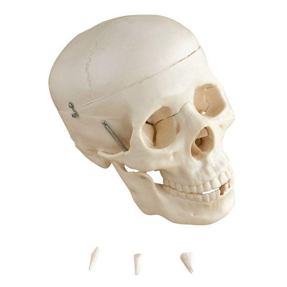 Cranio Humano Dividido Em 5 Partes