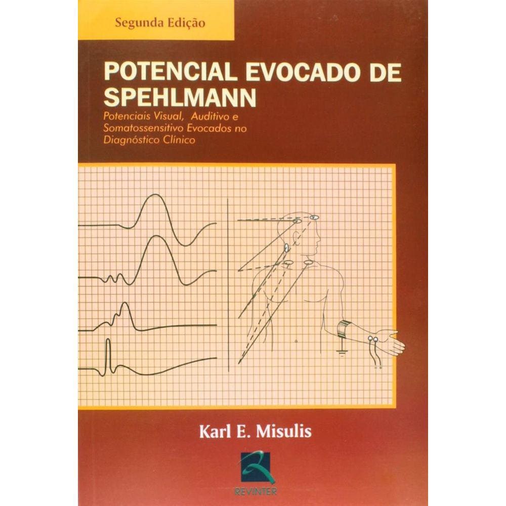 Potencial Evocado De Spehlmann