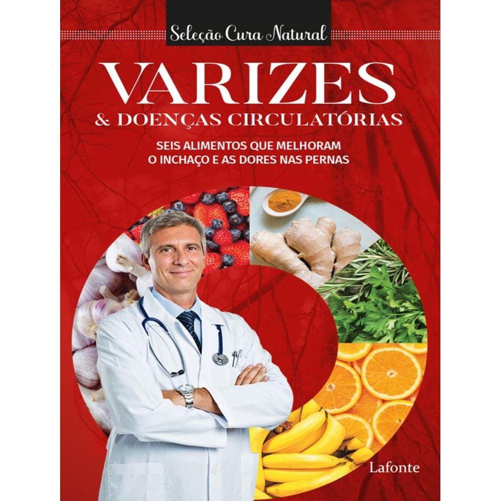 Varizes E Doenças Circulatorias