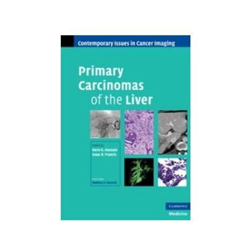 Primary Carcinomas Of The Liver