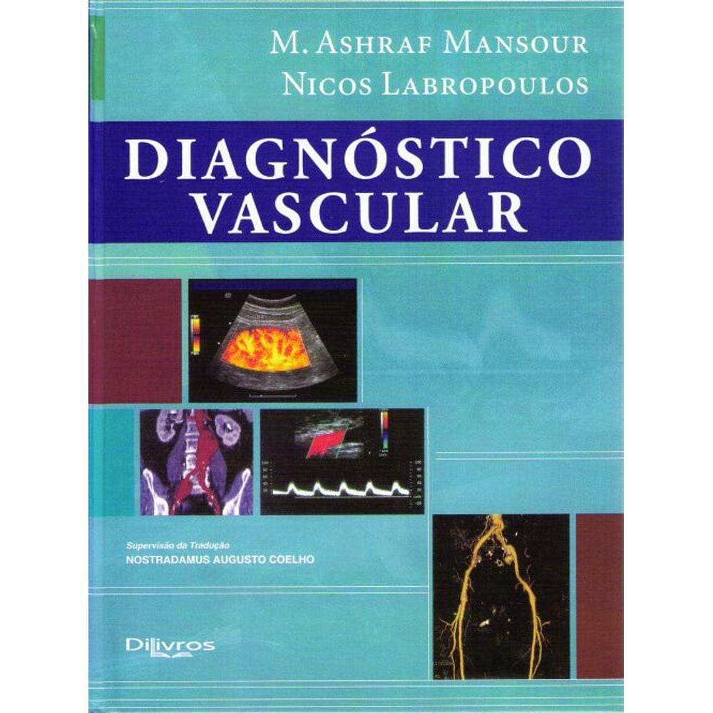 Diagnostico Vascular