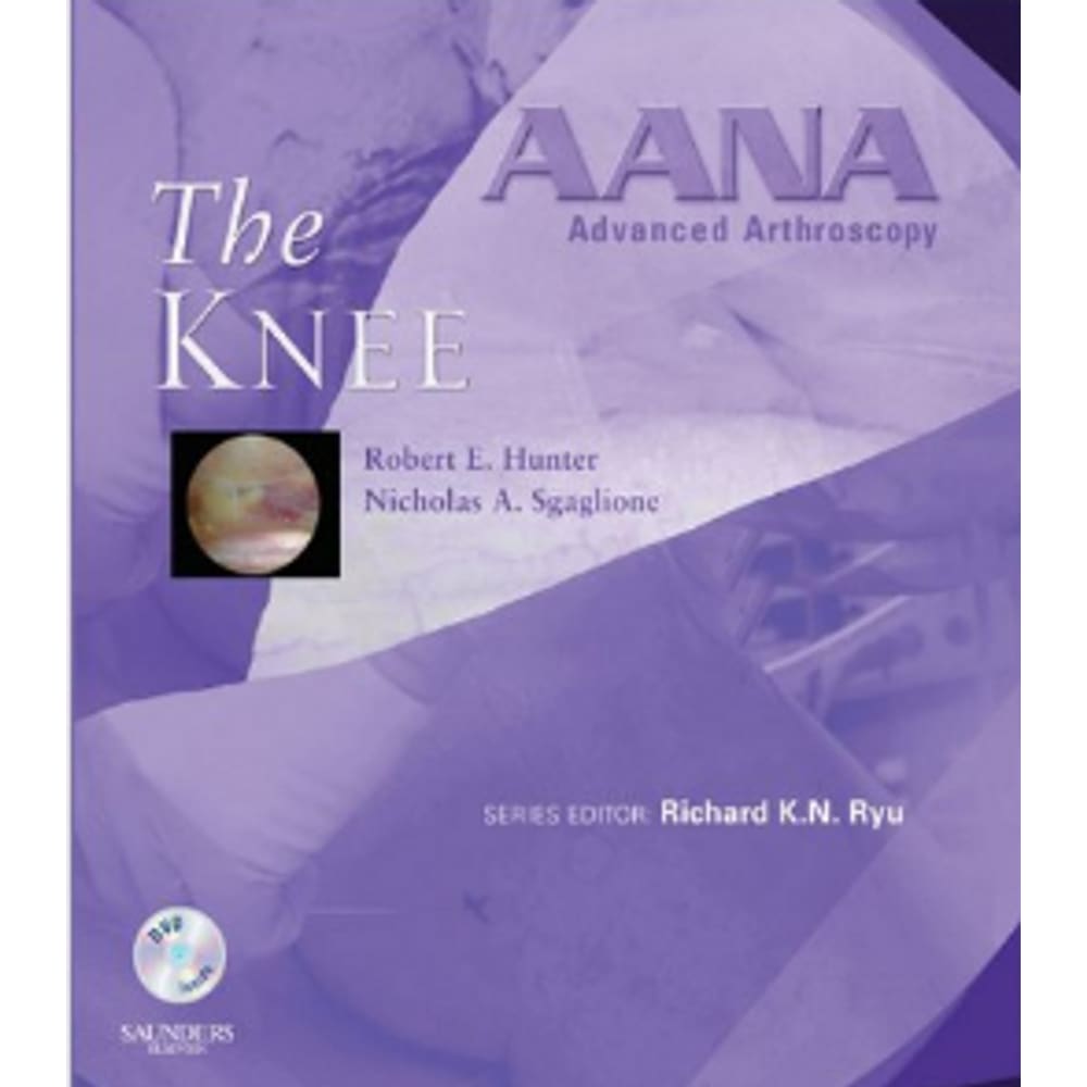 Aana Advanced Arthroscopy The Knee
