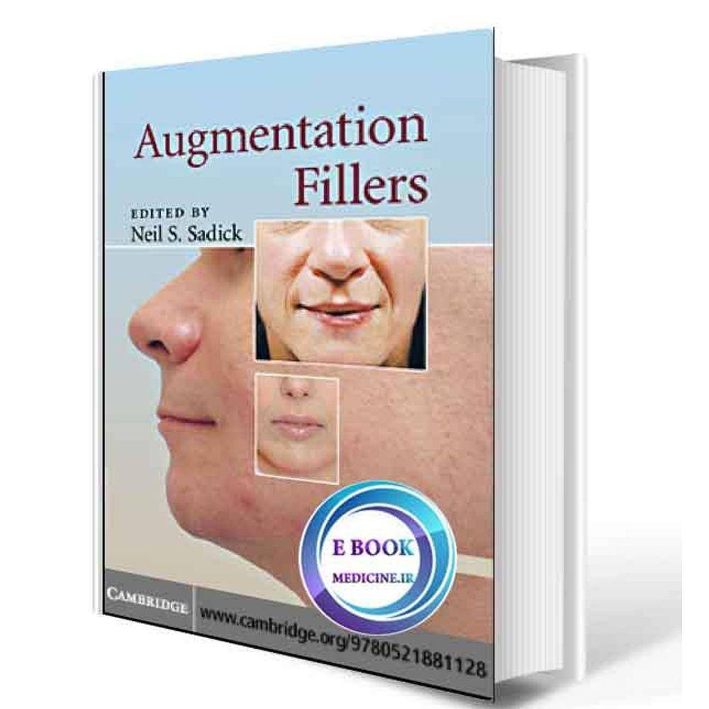 Augmentation Fillers
