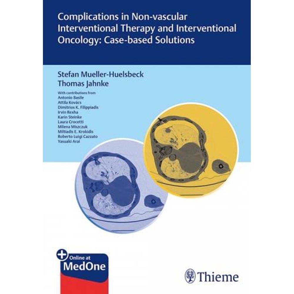 Complications In Non-Vascular Interventional Therapy And Interventional Onc