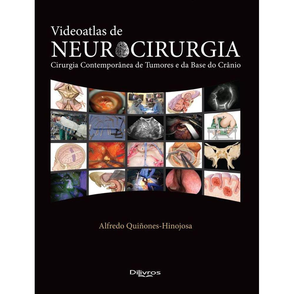 Videoatlas De Neurocirurgia