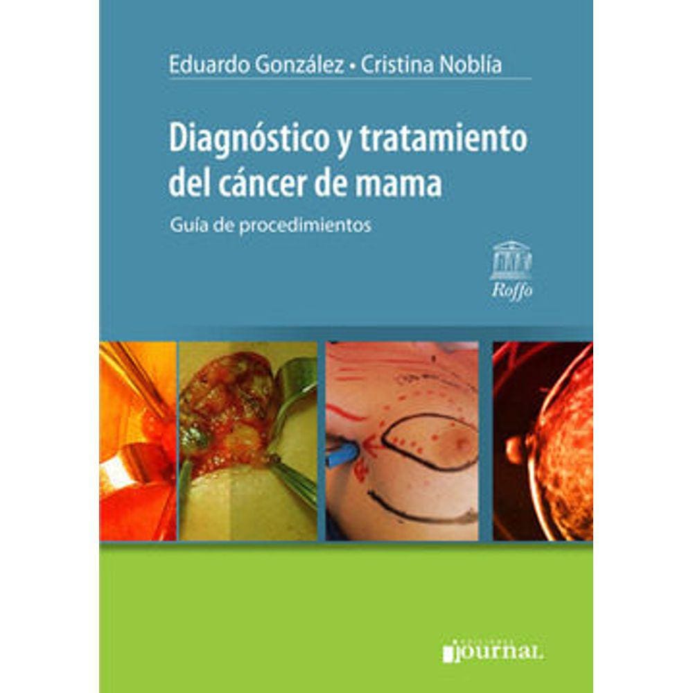 Diagnostico Y Tratamiento Del Cancer De Mama