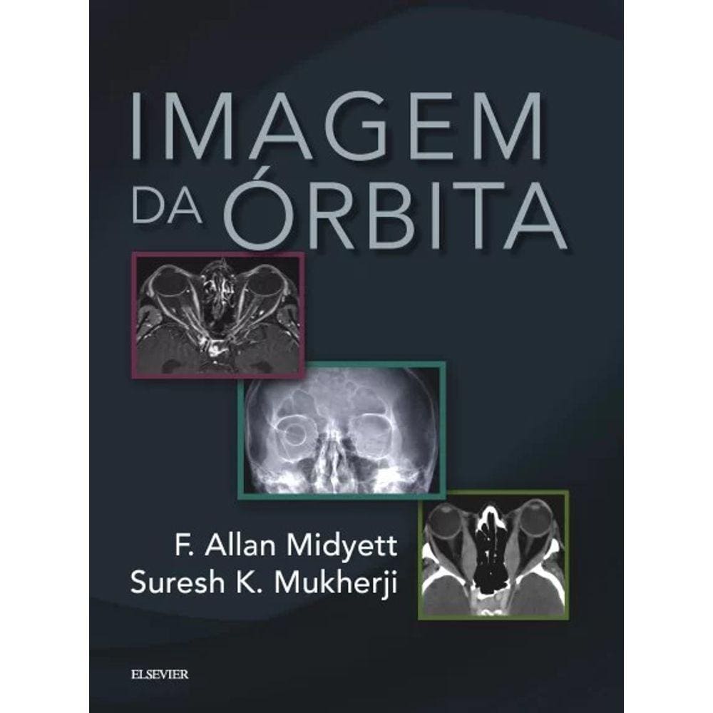 Imagem da Órbita