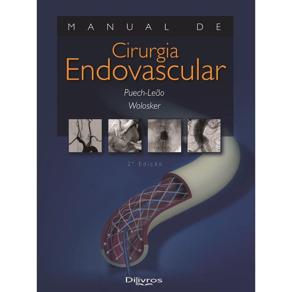 Manual De Cirurgia Endovascular