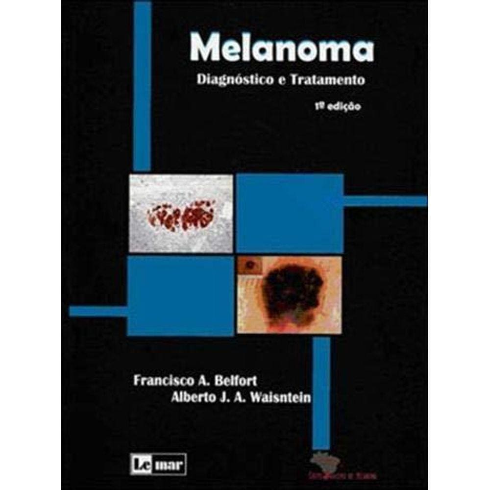 Melanoma - Diagnostico E Tratamento