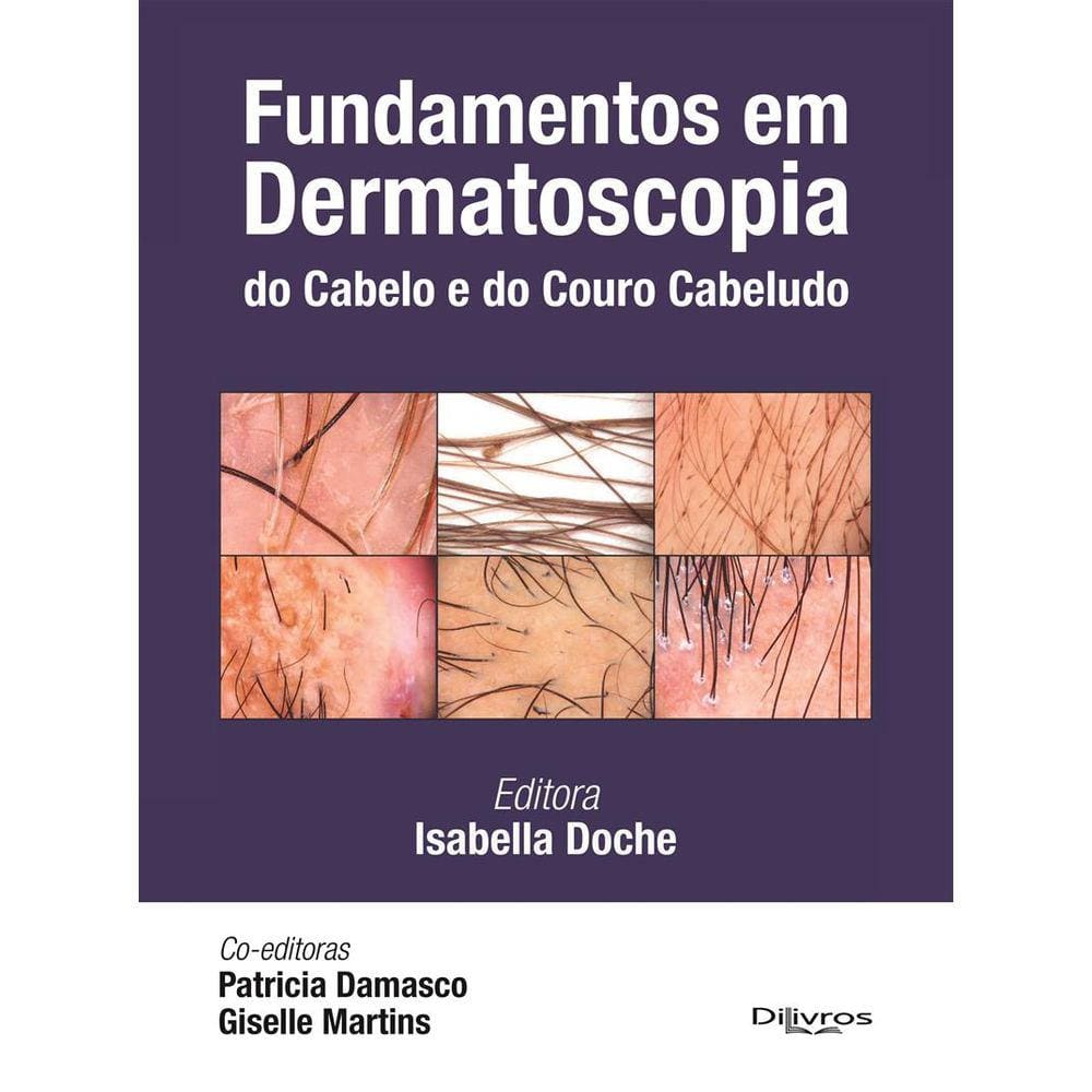 Fundamentos Em Dermatoscopia Do Cabelo E Do Couro Cabeludo