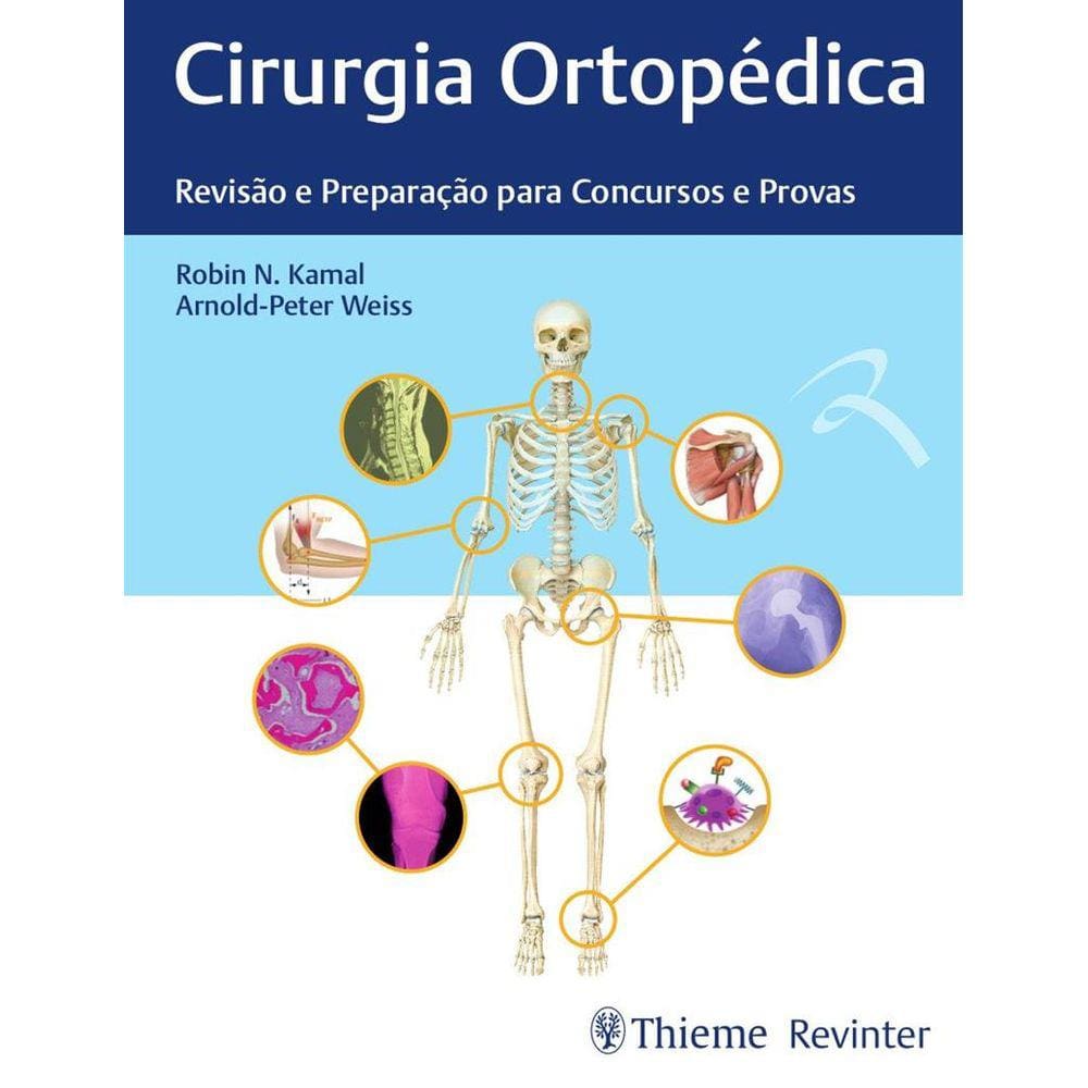Cirurgia Ortopedica Revisao E Preparacao Para Concursos E Provas