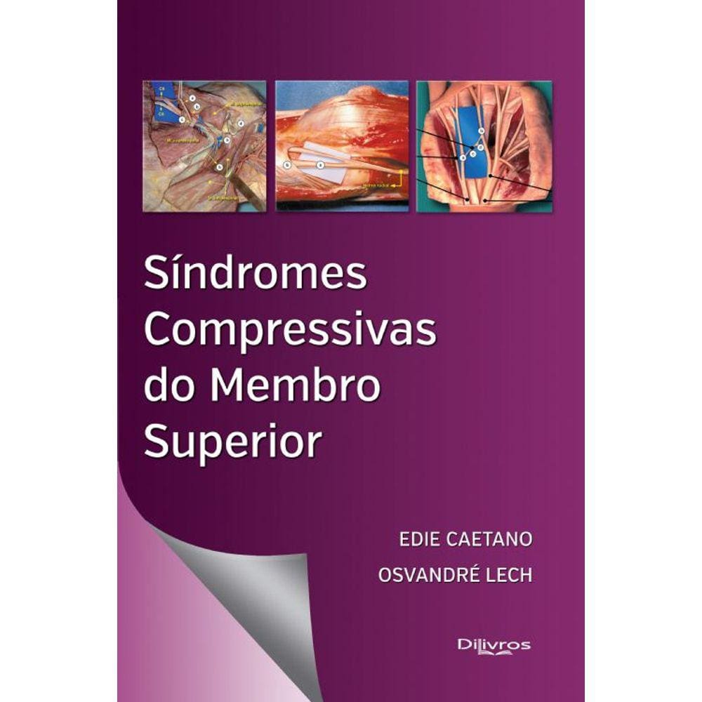 Sindromes Compressivas Do Membro Superior