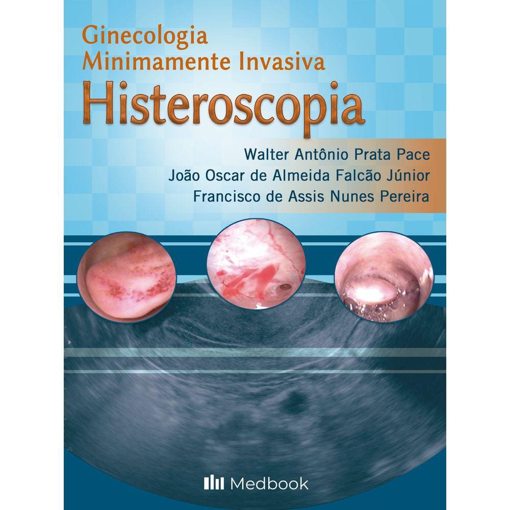 Histeroscopia Ginecologia Minimamente Invasiva