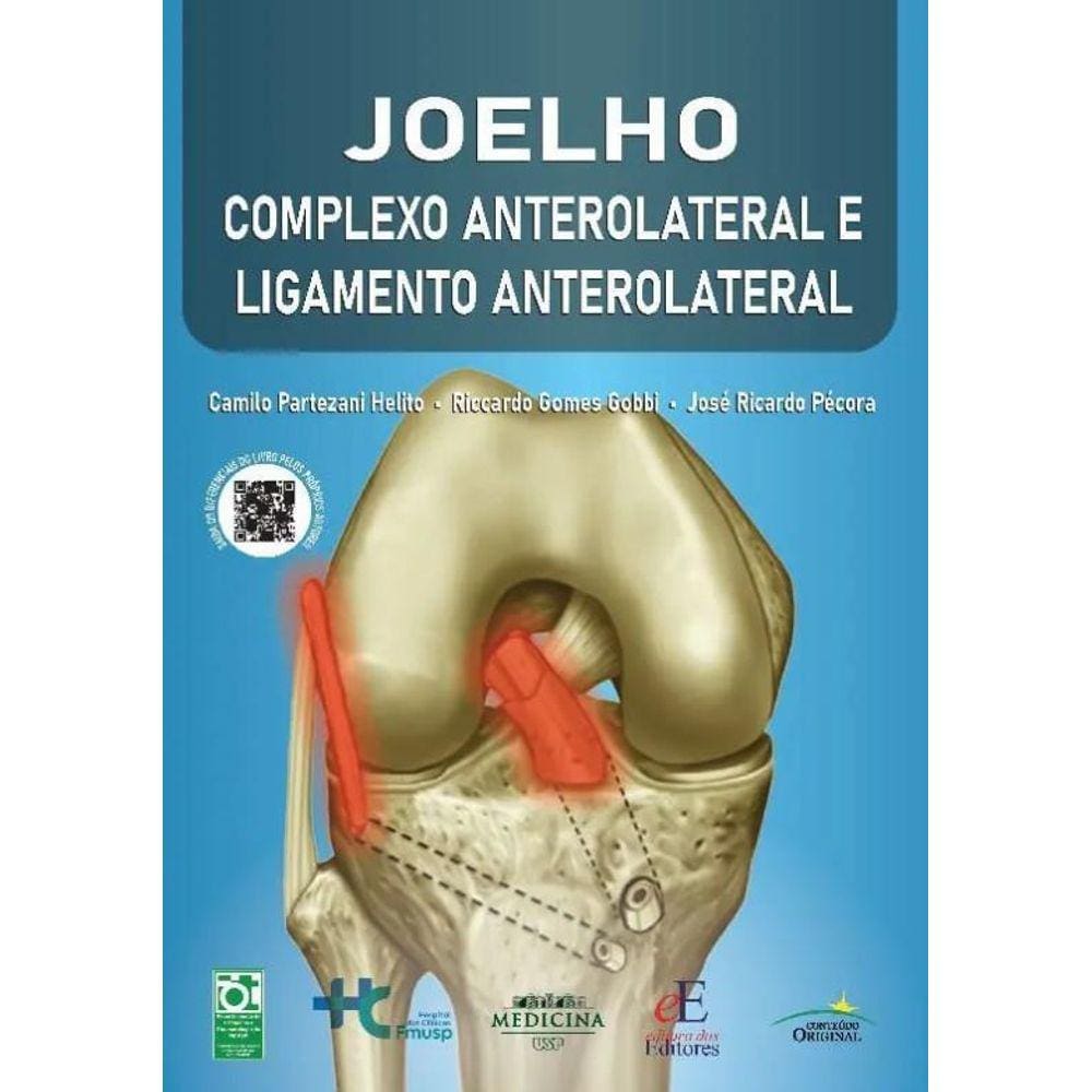 Joelho Complexo Anterolateral E Ligamento Anterolateral