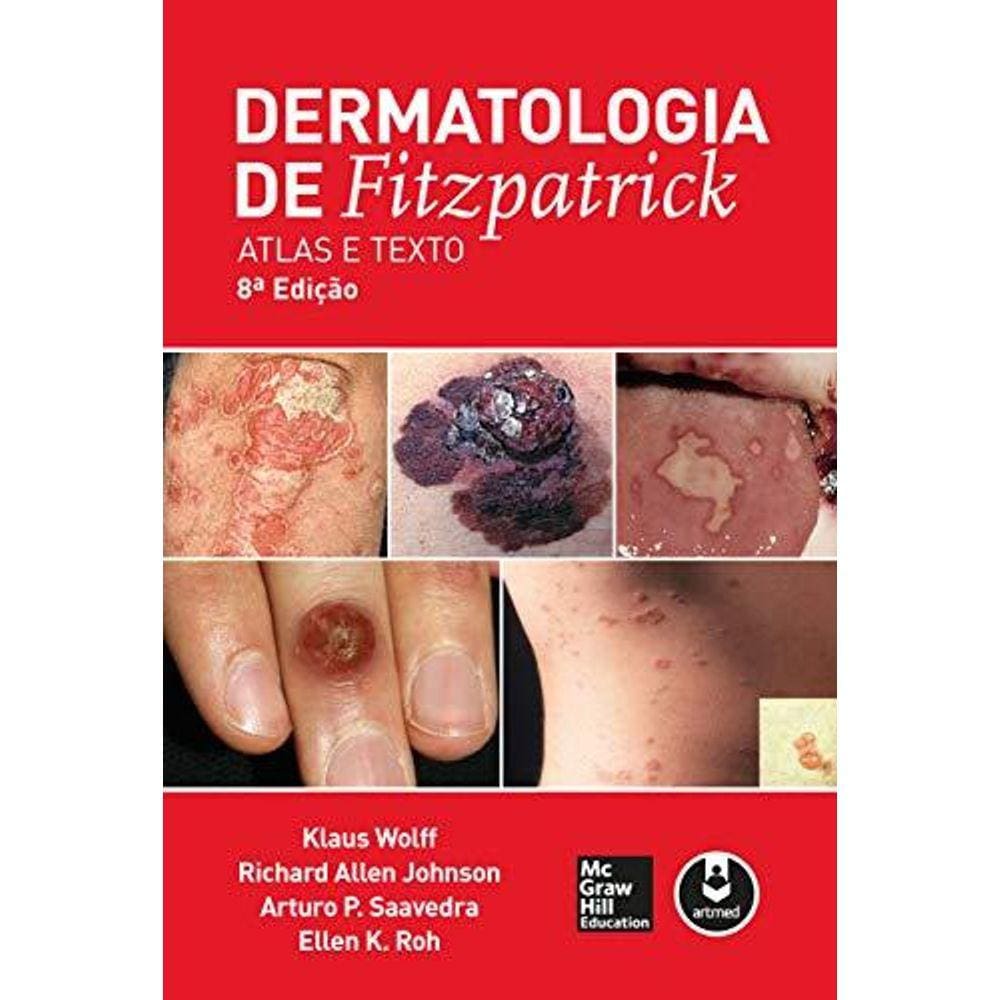 Dermatologia de Fitzpatrick - Atlas e Texto