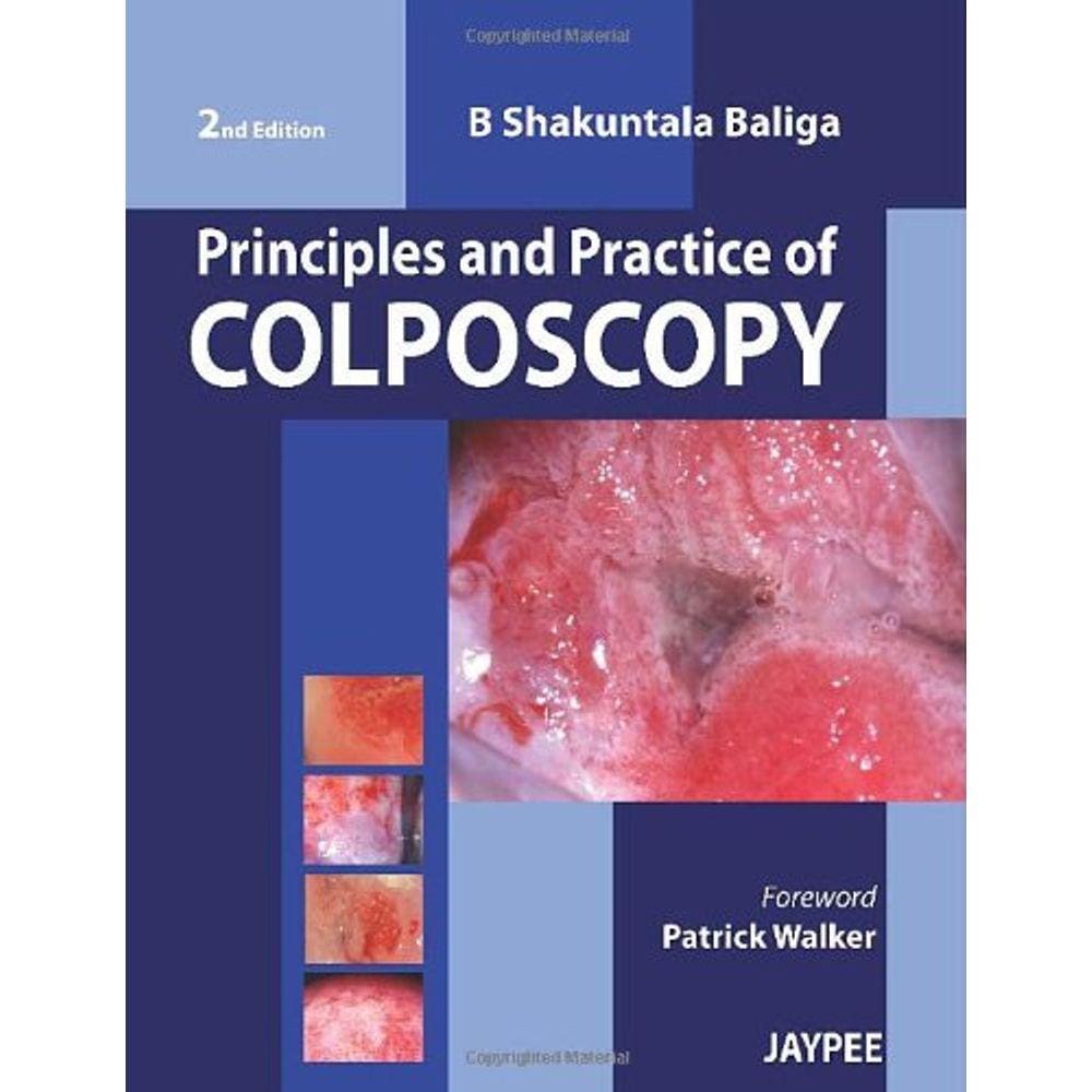 Principles And Practice Of Colposcopy