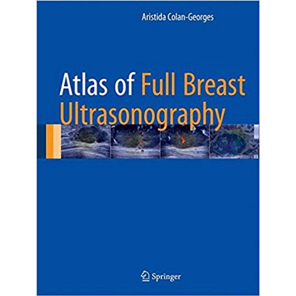 Atlas Of Full Breast Ultrasonography