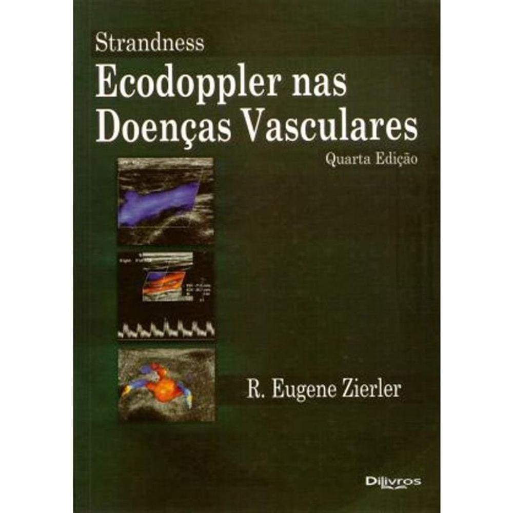 Strandness Ecodoppler Nas Doencas Vasculares