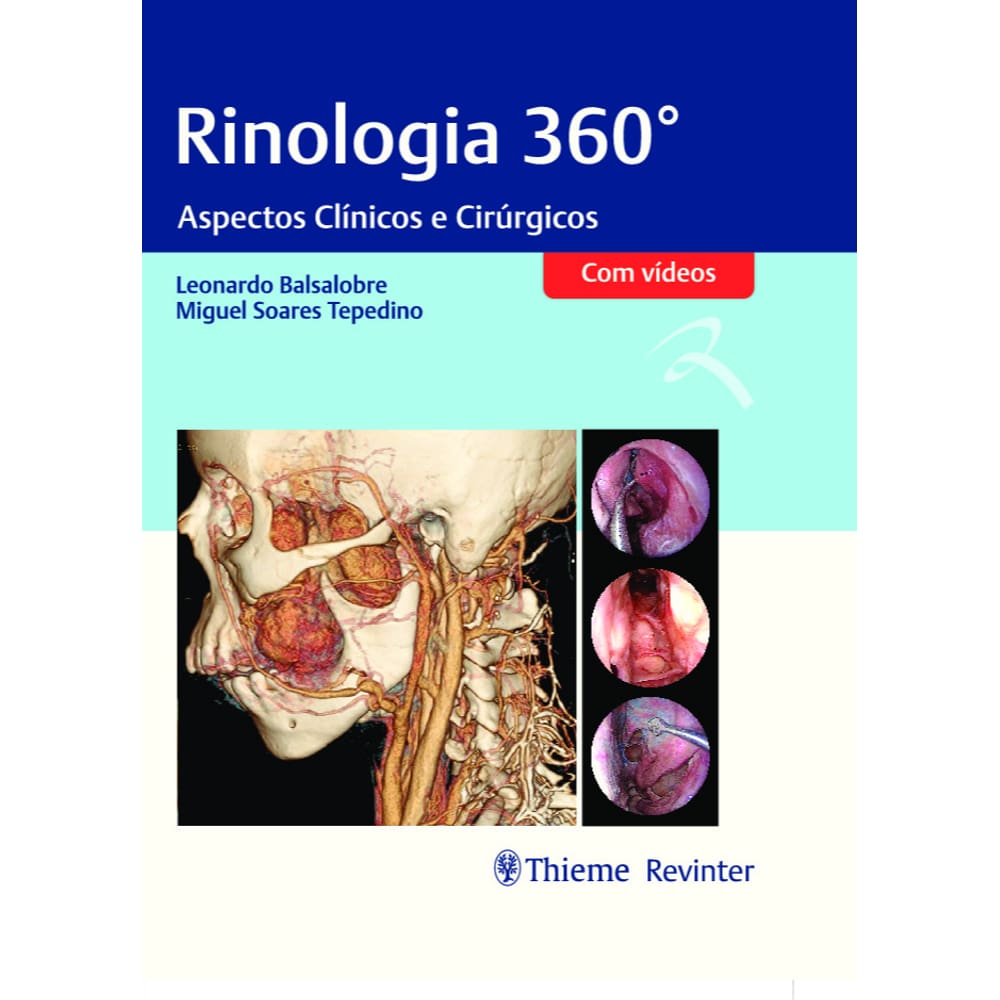 Rinologia 360 º   Com Videos