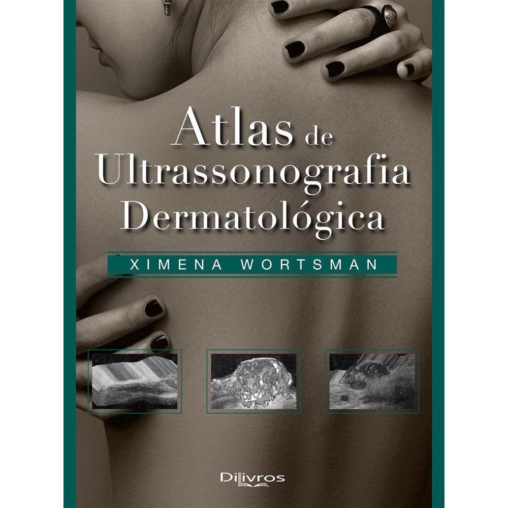 Atlas De Ultrasonografia Dermatologica