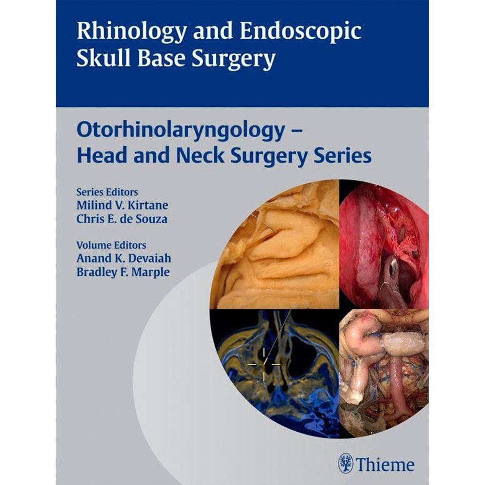 Rhinology And Endoscopic Skull Base Surgery